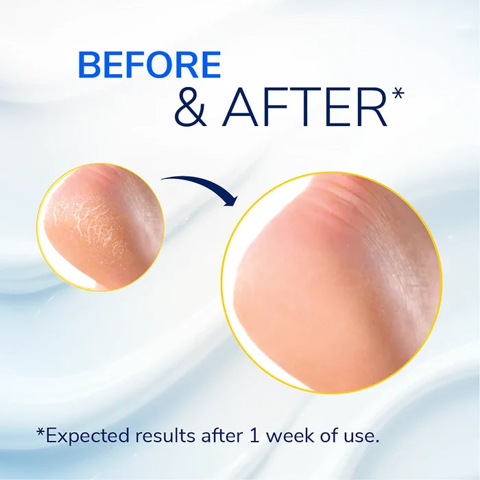 Before-and-after cracked heel skin circles for visible smoothness