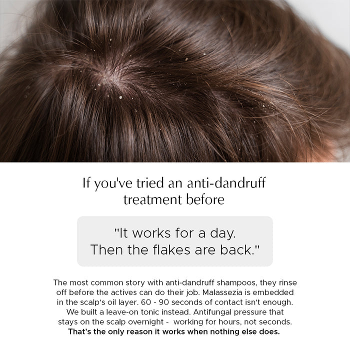 Anti Dandruff Scalp Tonic For Reduced Irritation & Scalp Health