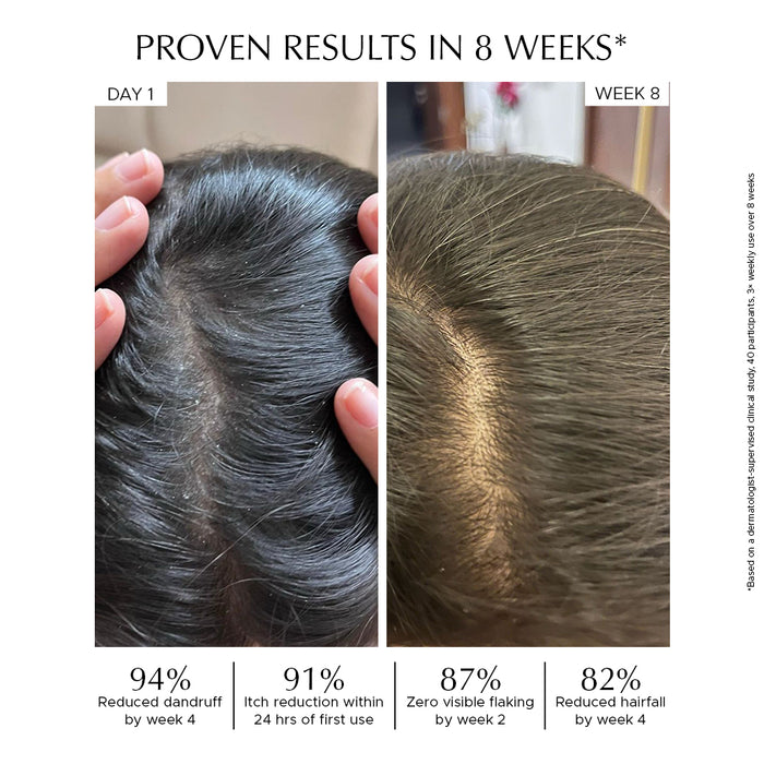 Anti Dandruff Scalp Tonic For Reduced Irritation & Scalp Health