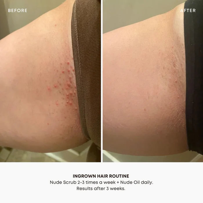 Bush Balm Ingrown Hair Oil