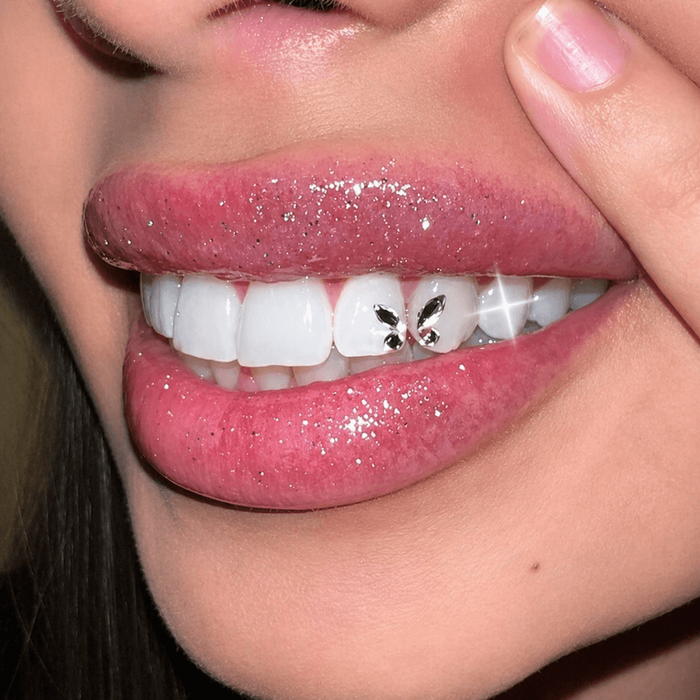 Crystal butterfly tooth gem on front tooth