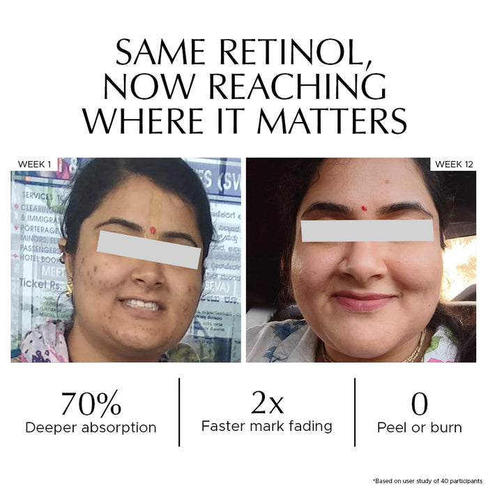 Combo: Encapsulted Cica Reedle Essence + Vitamin A Pro Retinol