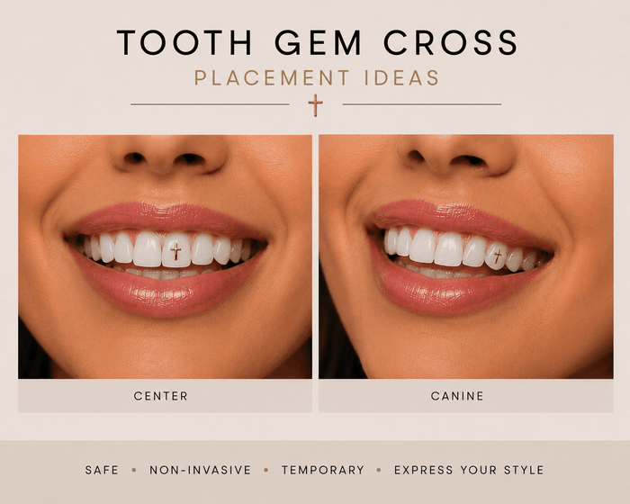 Cross tooth gem placement ideas showing center and canine placement on front teeth