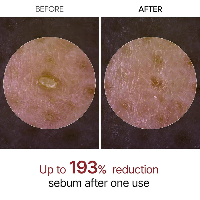 Dr.Melaxin White Rice Exfoliating Ampoule 80ml | VGLE Beauty Canada