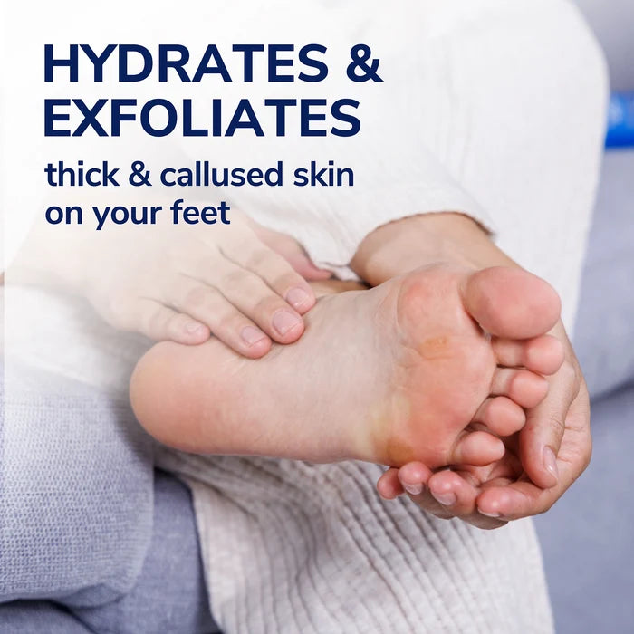 Foot lotion being massaged onto a heel and arch, with visible dry skin