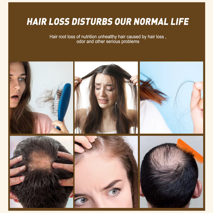 EELHOE Ginger Shampoo Anti-Dropping EELHOE COSMETICS