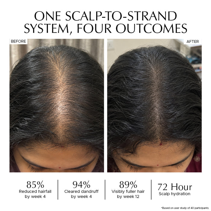Haircare Combo: Anti-Dandruff Scalp Tonic + Hair Vitalizer 2.0 + Rosemary & Rice Water Mist