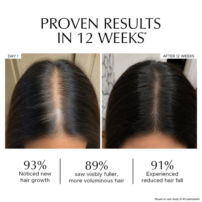 Luxuriant Hair Vitalizer 2.0 | Anti Hairfall Non Oily Hair Growth Serum
