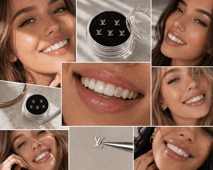 Lifestyle collage featuring silver LV-inspired tooth gems, five metallic tooth gems in an acrylic display case, and close-up smile photos showing luxury tooth jewelry worn on teeth.