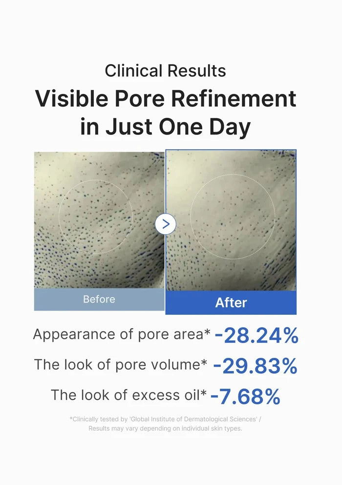 Before and after comparison of visible pore refinement with clinical results on a white background.