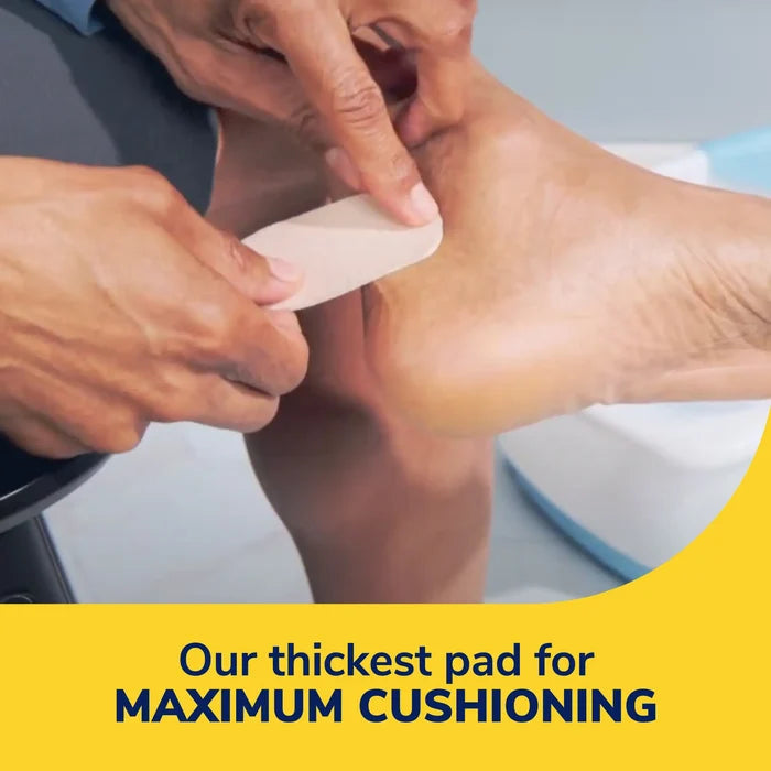 Beige Molefoam padding strip being applied to a foot for cushioning
