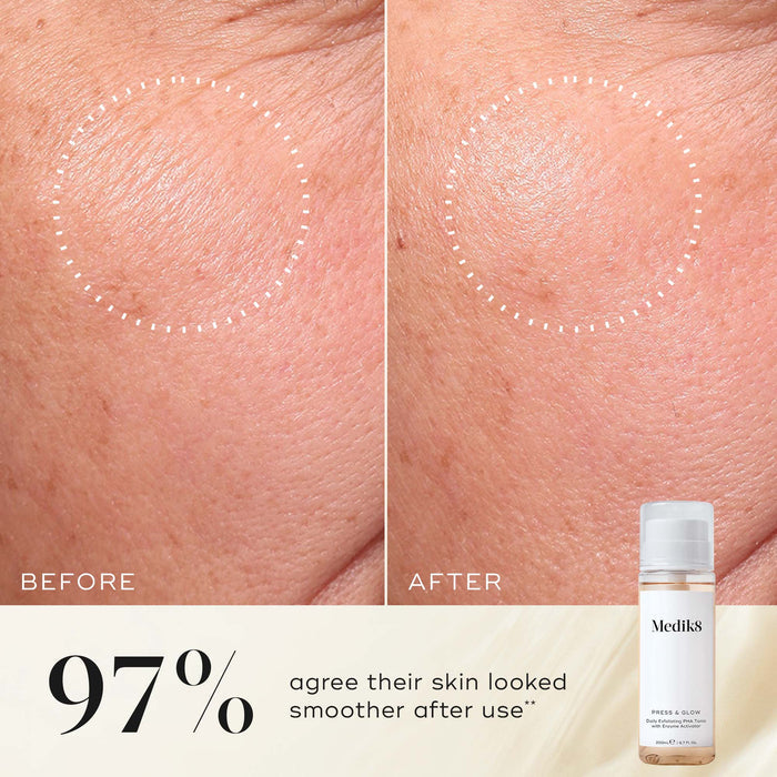 Before and after close-up of a participant’s skin on the cheek, demonstrating a smoother texture and more even appearance. The Medik8 Press & Glow tonic bottle is shown in the corner. Text highlights that "97% agree their skin looked smoother after use**."