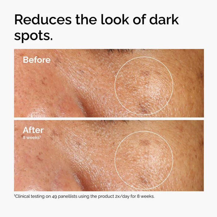 The Ordinary Alpha Arbutin 2% & HA Serum