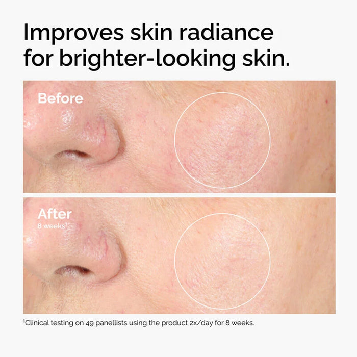 The Ordinary Alpha Arbutin 2% & HA Serum